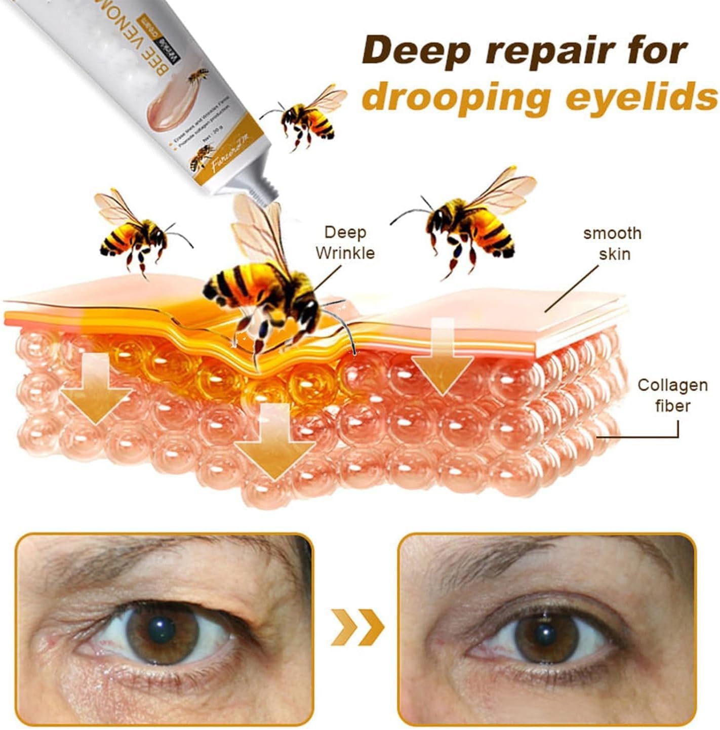 Botox Bee Venom Cream